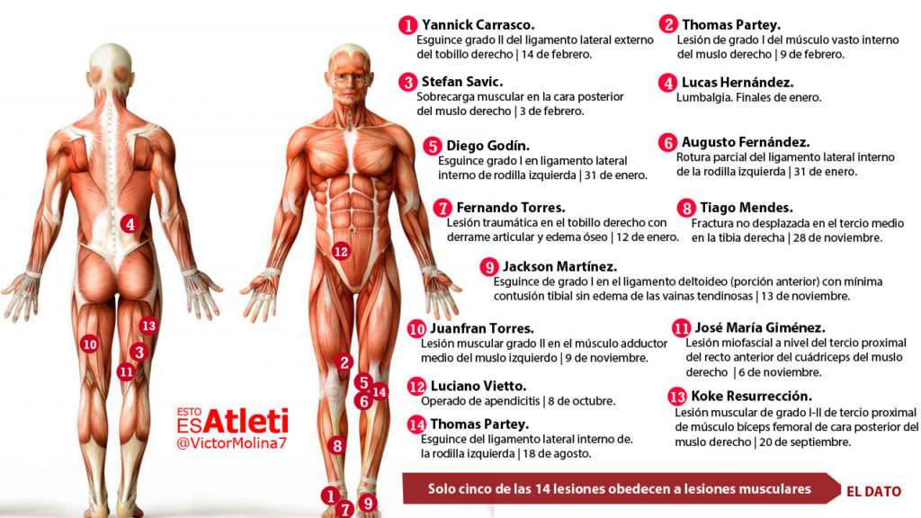 20160221-Infografia-Lesiones-Jugadores-Atletico