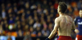 Así quedó la espalda de Vietto tras la patada de Siqueira