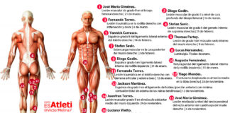 La factura de ser ‘Premium’